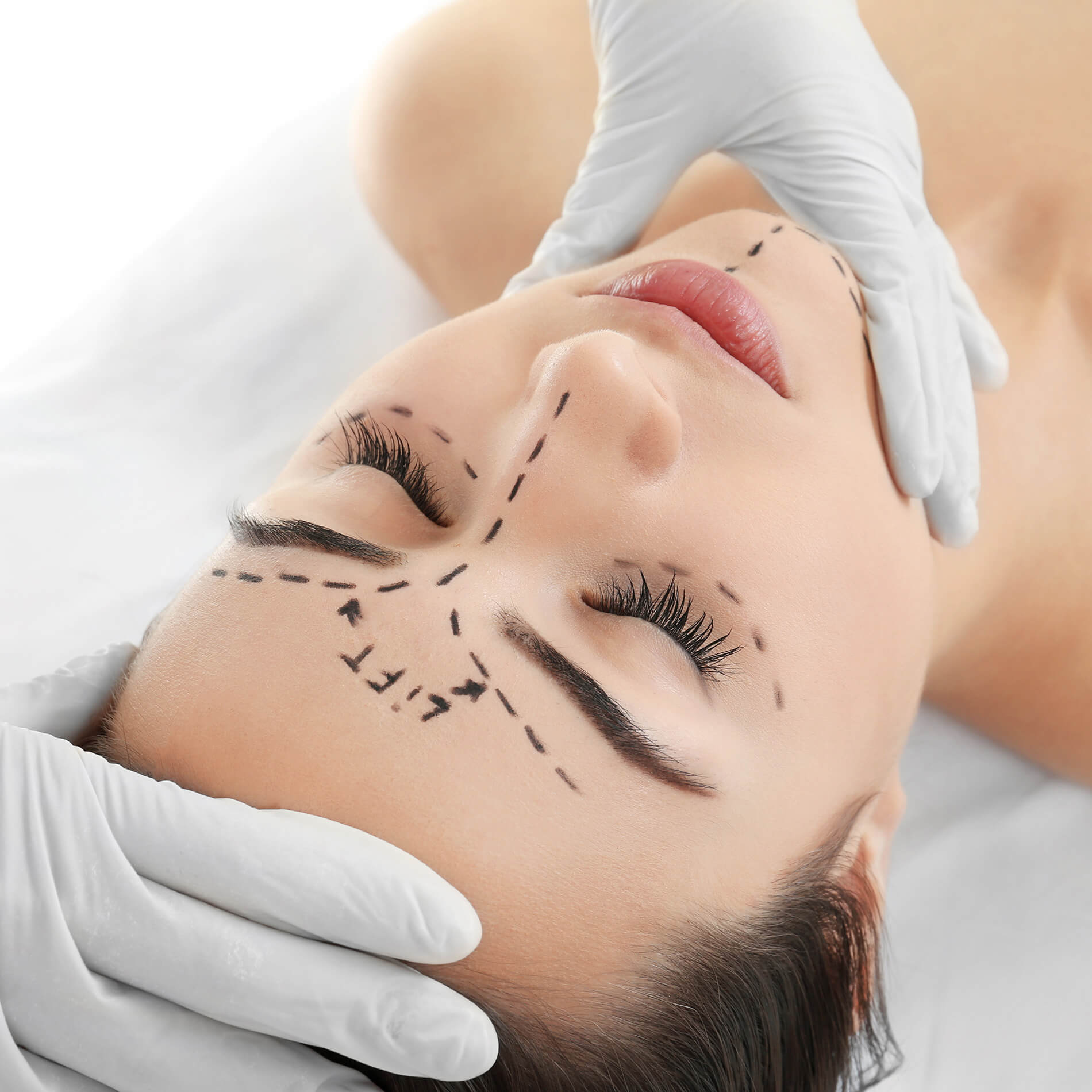 Eyelid Surgery